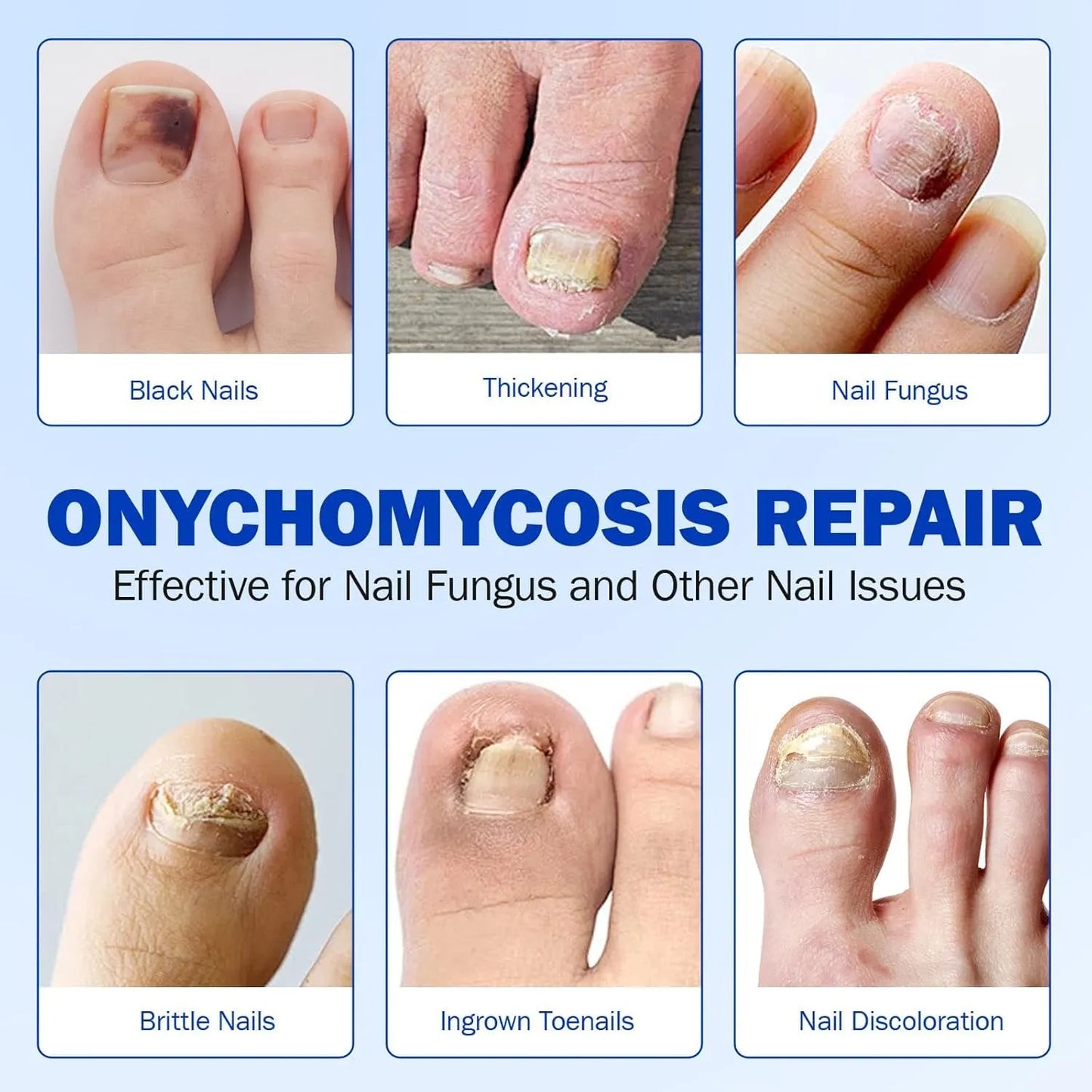 Fungal Nail Treatment Patches