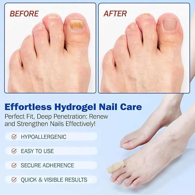 Fungal Nail Treatment Patches
