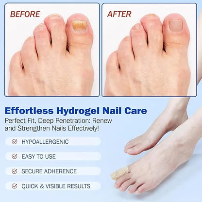 Fungal Nail Treatment Patches