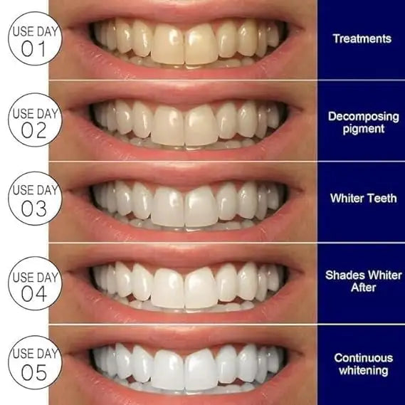 Teeth Whitening Strips Kit
