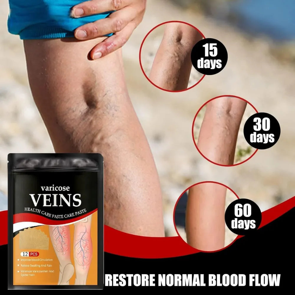 Varicose Veins Health Care Paste Pain Relief & Blood Circulation Support