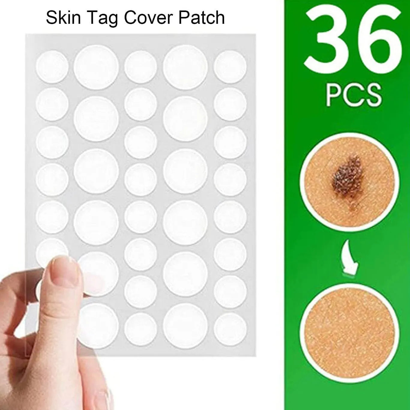 Anti-Acne Hydrocolloid Pimple Patches (36 Pcs)