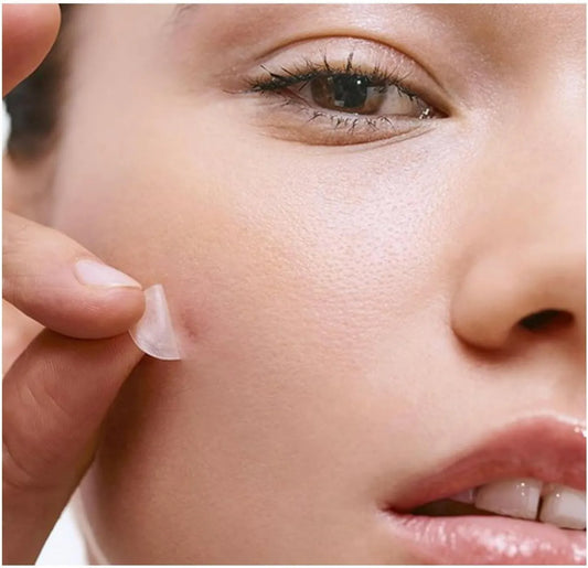 Anti-Acne Hydrocolloid Pimple Patches (36 Pcs)