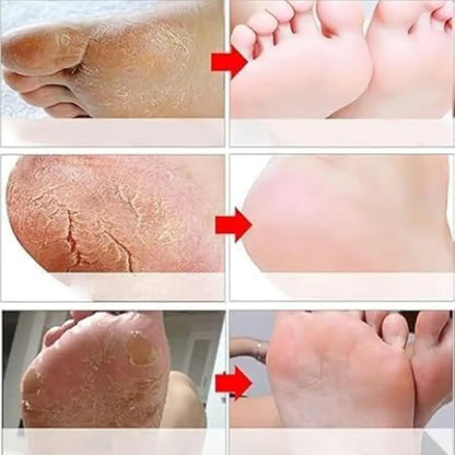 Goat Milk Exfoliating Foot Mask with Nicotinamide