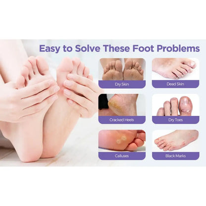 Goat Milk Exfoliating Foot Mask with Nicotinamide