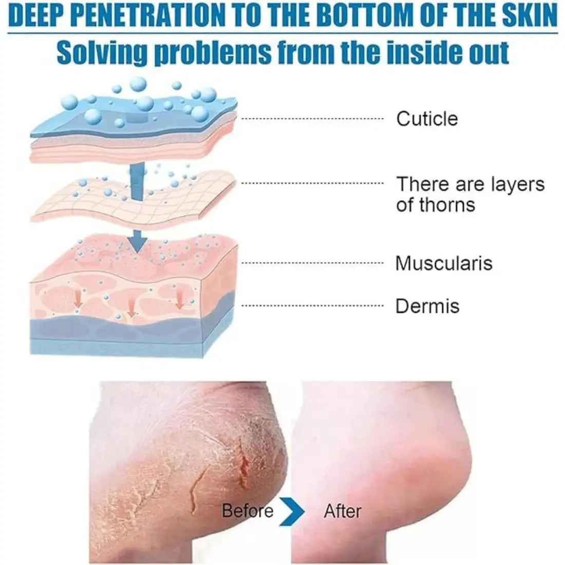Goat Milk Exfoliating Foot Mask with Nicotinamide
